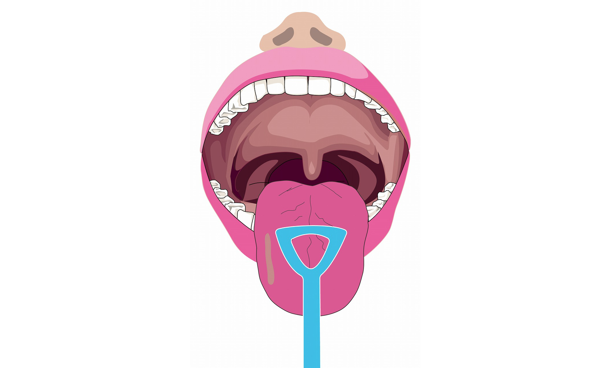 3.白い舌苔の取り方、対処法