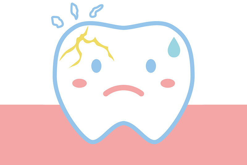 歯が割れる、歯根破折の原因と治療法は？