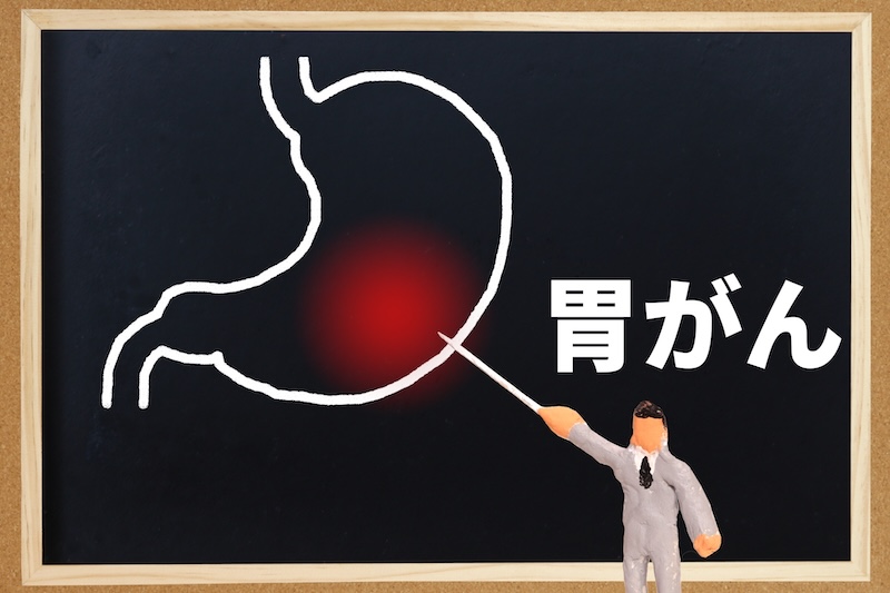 歯周病と胃潰瘍、胃がん、ピロリ菌との関係について