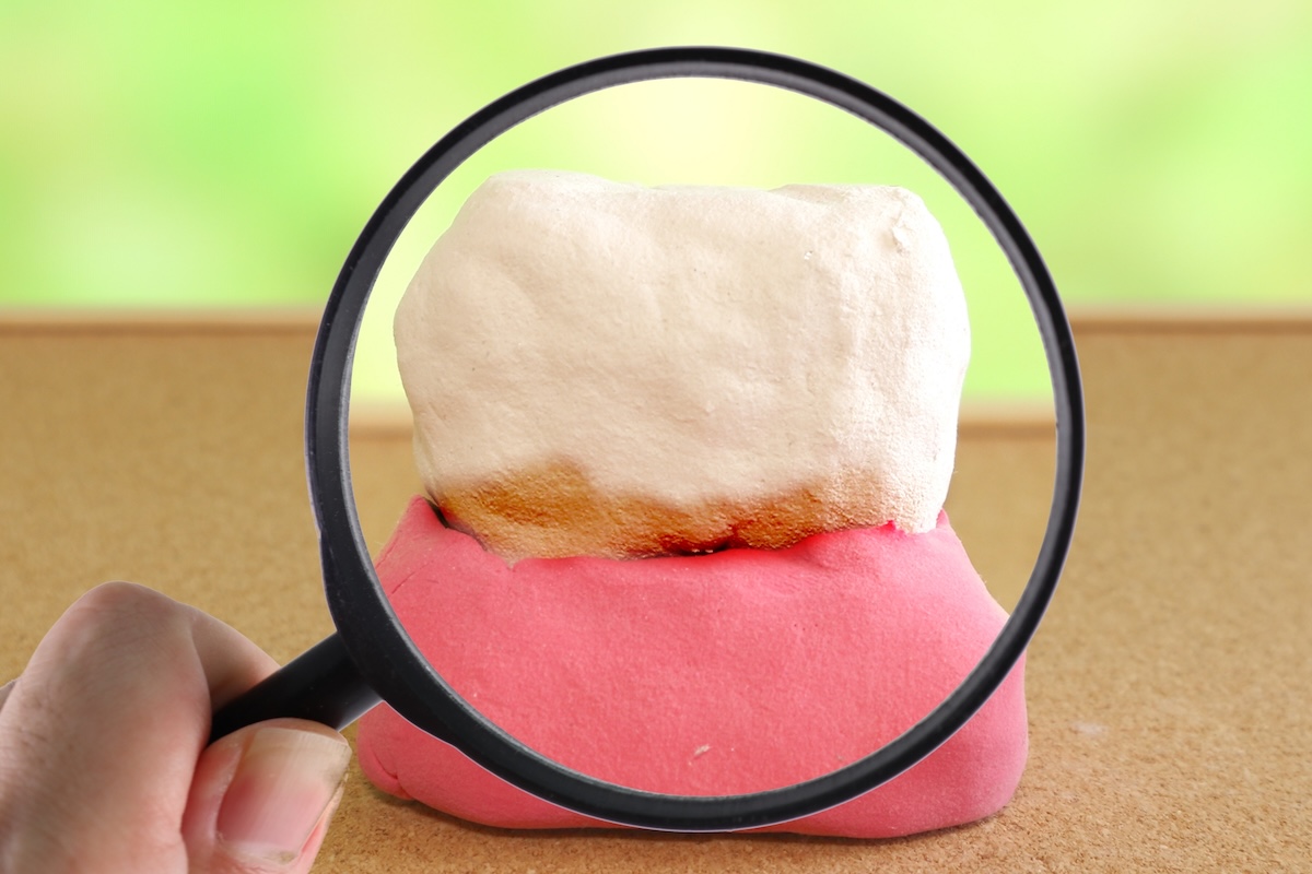 2. なぜ歯磨きだけでは「限界」なの？