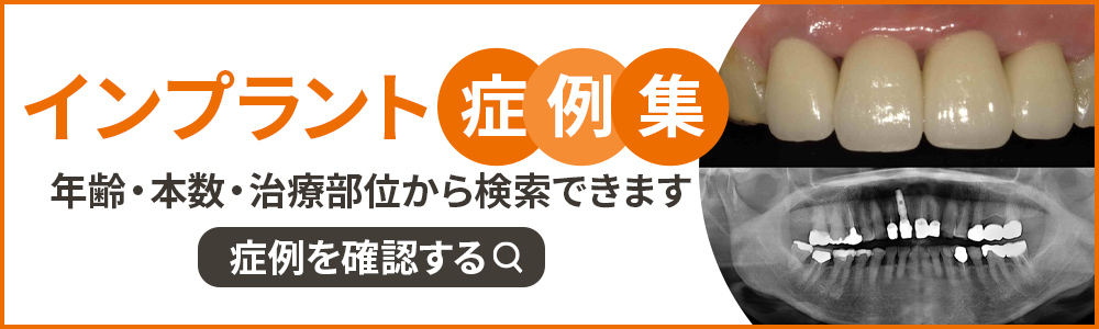 インプラント症例