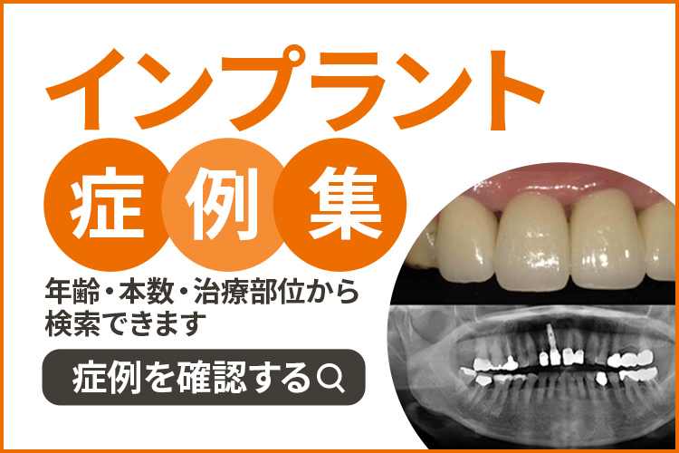 インプラント症例