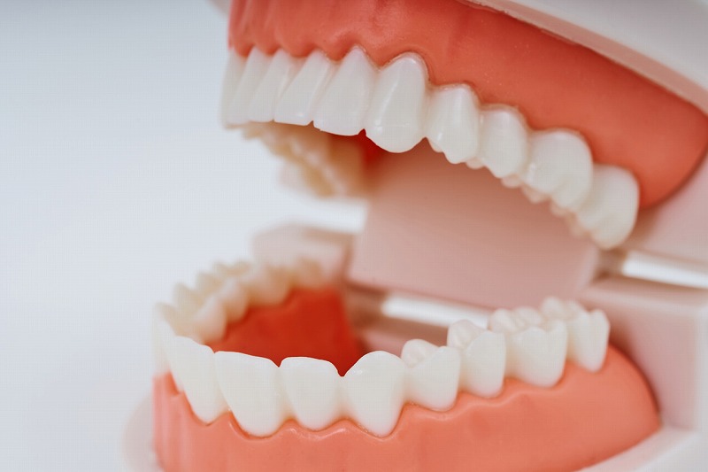 2.矯正歯科治療が保険診療の適用になる症例・条件とは