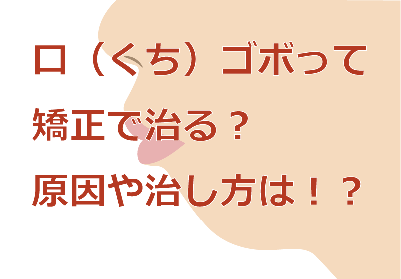 口（くち）ゴボって矯正で治る？原因や治し方は！？