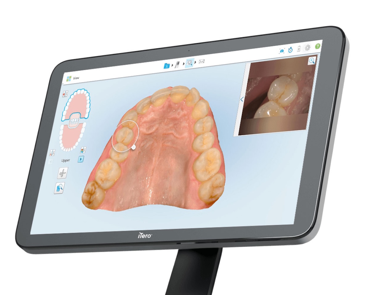 そのインビザライン、精度は大丈夫?「iTero」導入クリニックを選ぶだけで「仕上がり」に差がつく理由